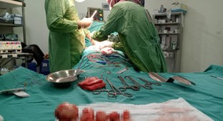 Ağrı şikayetiyle hastaneye gitti, rahim duvarından 23 miyom çıkarıldı