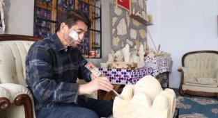 Kansere yakalandı, sanatla hayata tutundu