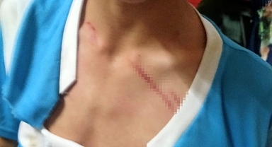 Hayvan otlatma meselesi kanlı bitti: 2 yaralı