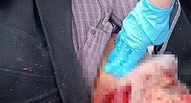 Malatya'da tartıştığı babasını tahra ile öldürdü