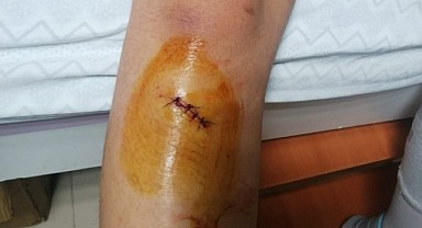 Voleybolda Kara Gün...