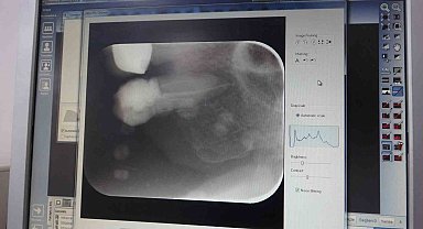 İnönü Üniversitesi Diş Hekimliği Fakültesi'ne 1 yılda 303 bin hasta başvuru yaptı