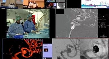 Canlı yayında zorlu beyin ameliyatı