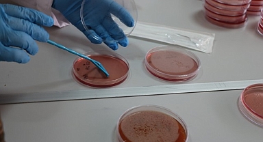 Çiğ süt, gıdayla bulaşan idrar yolu enfeksiyonlarına kapı açıyor